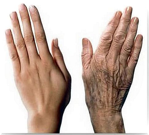 Aging of the hands: 7 beauty tips