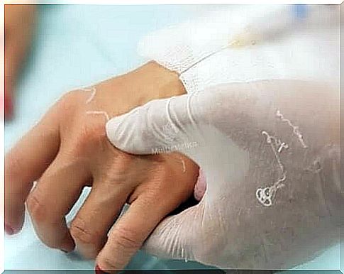 Mesotherapy against aging of the hands