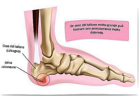 Heel spine