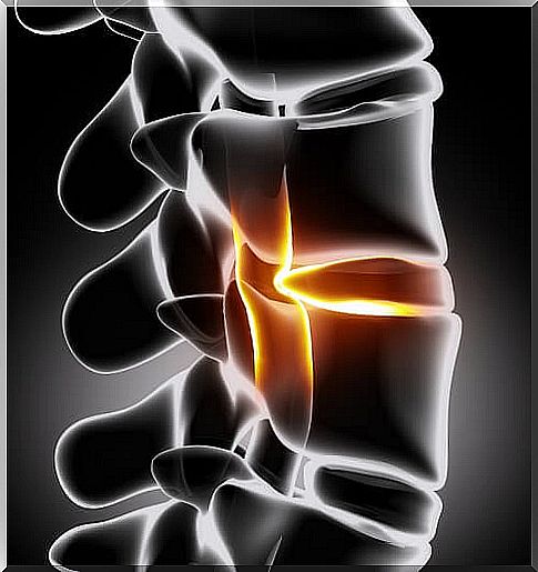 The intervertebral discs are responsible for the herniated disc