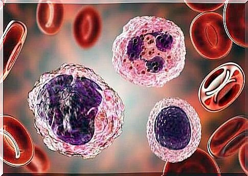 High blood monocytes: symptoms and treatments