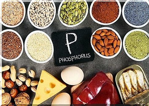 Hyperphosphatemia: high concentrations of phosphate in the blood