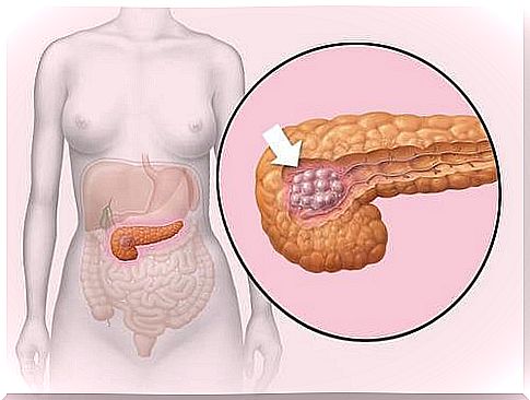 Pancreas: what function does it perform and how to take care of it?