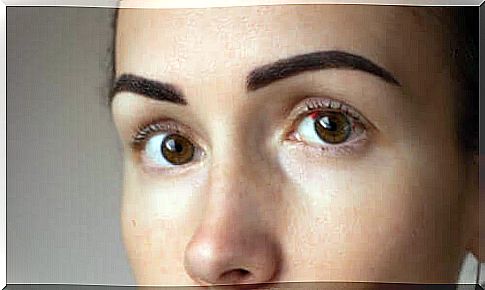 Red spots in the eyes: why do they appear?