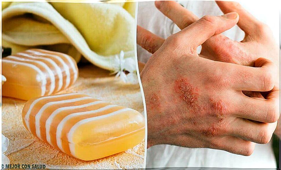 Soap for dermatitis with propolis and clay