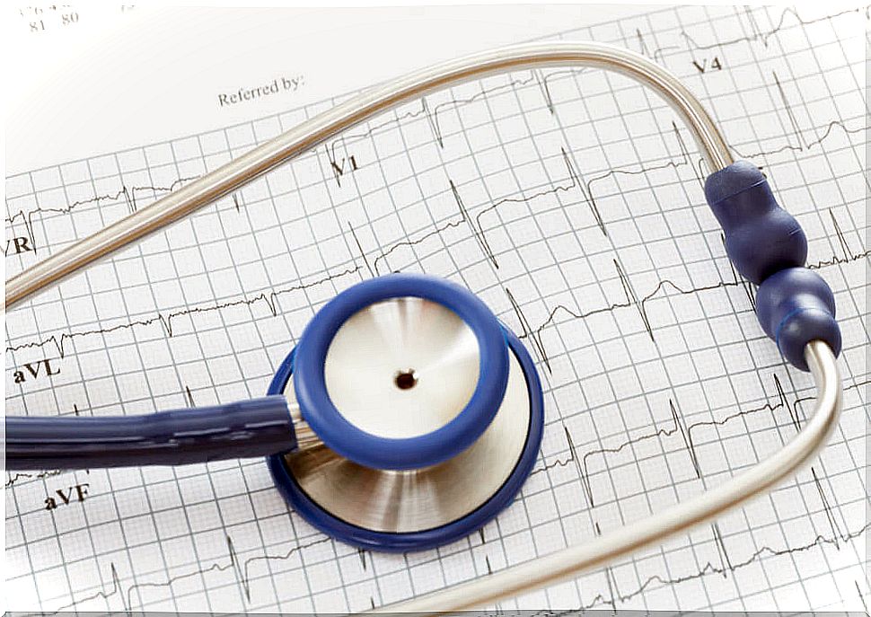 Electrocardiogram and stethoscope