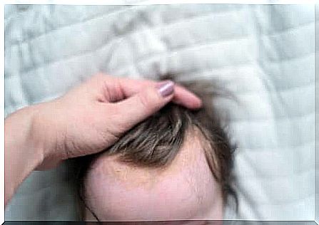 Cradle cap is one of the skin irritations of the newborn.